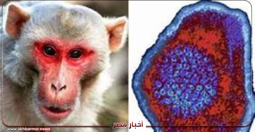 جدرى القرود