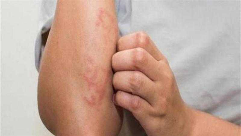 للوقاية المبكرة من الإصابة.. 13 علامة حديثة لاكتشاف السرطان
