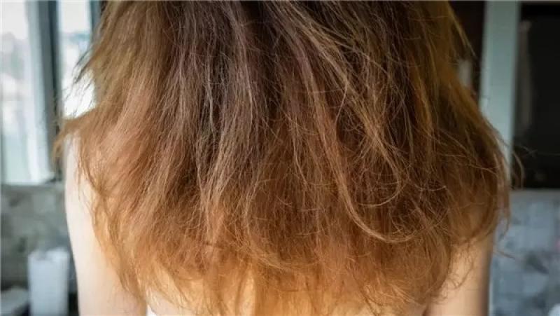 مصفف شعر يتحدث عن مشكلة ”التساقط”.. وهذه طرق الحل