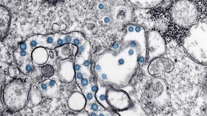 علماء يحذرون من الوباء الكبير: أكثر الأمراض المعدية فتكًا في تاريخ البشرية