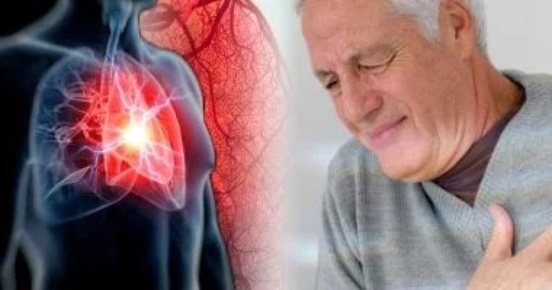 طرق معتمدة من الخبراء للوقاية من انسداد القلب