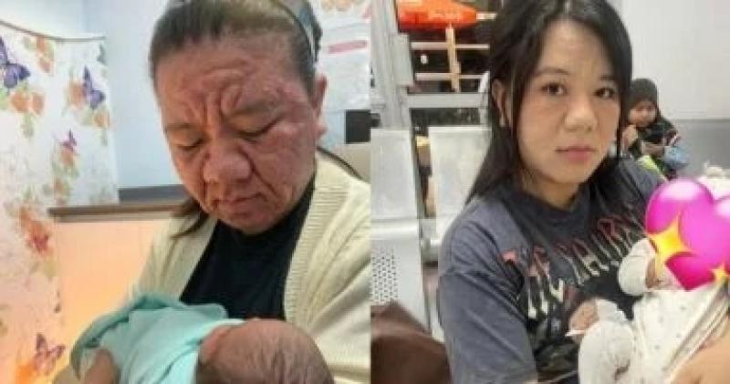 ماليزية 28 عاما تُعانى من تغيرات حادة فى مظهرها أثناء الحمل