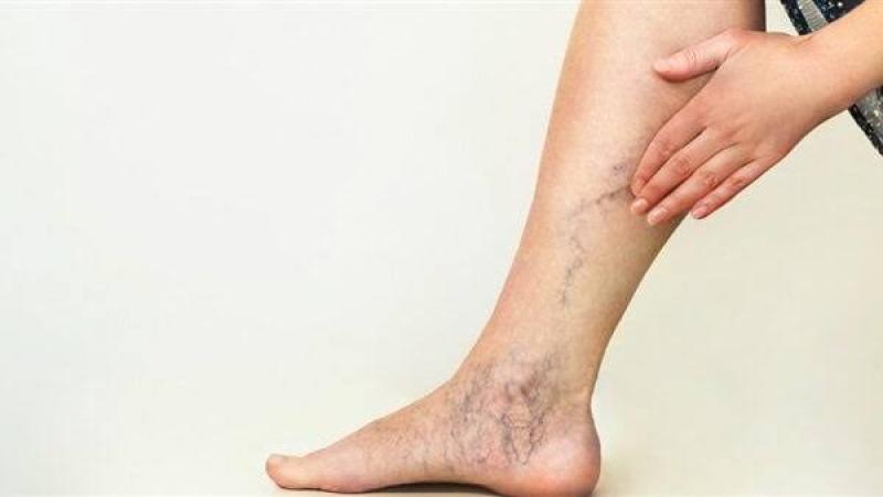 انتبه لصحة قدميك.. 6 إشارات خطيرة تكشف عن انسداد الشرايين