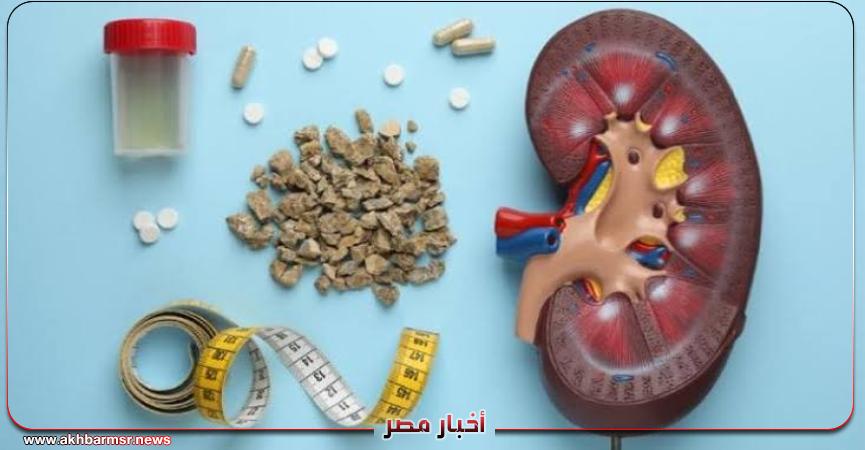 علامات مبكرة تكشف إصابتك بحصوات الكلى.. لا تتجاهلها