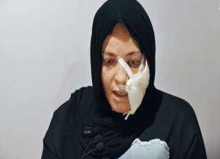 خلاف على قرض يتحول لاعتداء.. تفاصيل واقعة سائق بالإسكندرية خلاف على قرض يتحول لاعتداء.. تفاصيل واقعة سائق بالإسكندرية