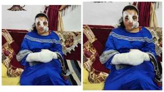 بسبب 500 جنيه.. شاب يعتدي على شقيقته بعنف مستخدمًا عكازًا حديديًا في... بسبب 500 جنيه.. شاب يعتدي على شقيقته بعنف مستخدمًا عكازًا حديديًا في الشرقية