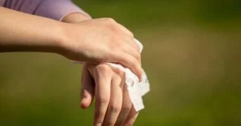 خبراء الصحة يحذرون من استخدام المناديل المبللة الخالية من الكحول على الجروح