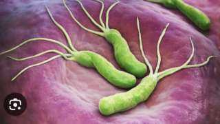 عاجل .. أعراض تدل على الإصابة بجرثومة المعدة .. أسبابها ومضاعفاتها الخطيرة ا