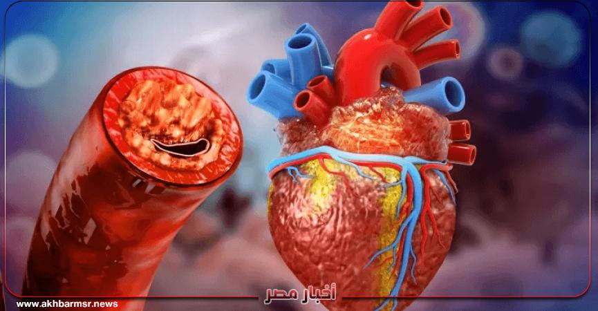 اطعمة تعزز صحة القلب وتخفض الكوليسترول