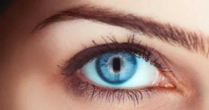جفاف العين مش من الموبايل بس.. أسباب خفية قد تكون وراء المشكلة