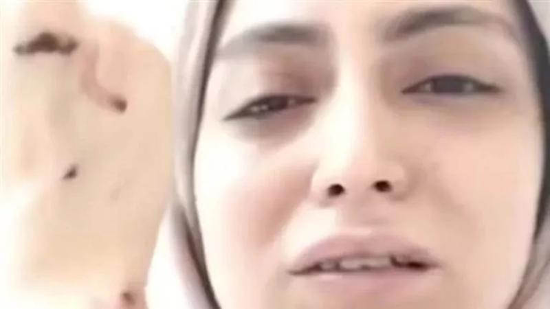 بعد إصابتها بكسر مضاعف.. مفاجآت جديدة في واقعة طبيبة الأسنان بشبرا الخيمة